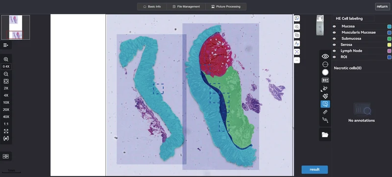 D-PathAI whole-slide viewer with tissue annotations and review controls
