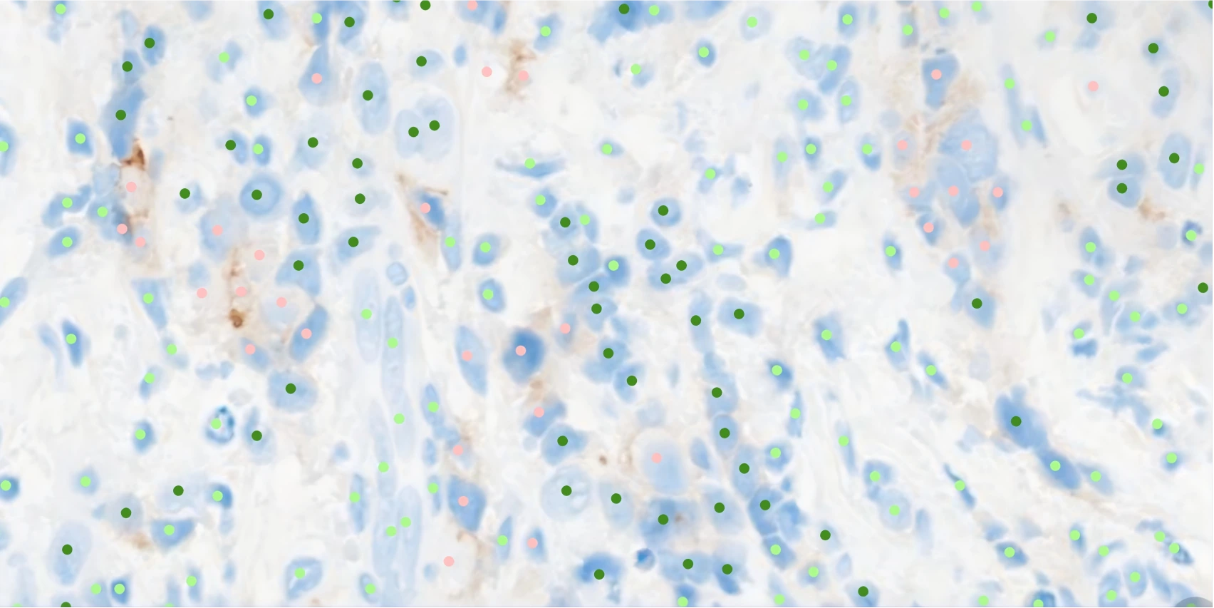 IHC Quantification